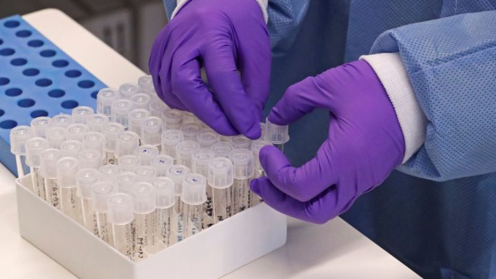 Pesquisas buscam entender novo coronavírus e apontar formas de combate