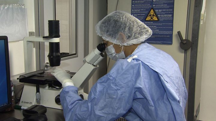 Células-tronco são usadas em estudo para combater a covid-19