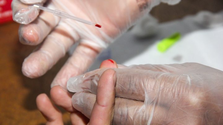 Campanha ‘Julho Amarelo’ traz testes rápidos para hepatites virais em Carapicuíba